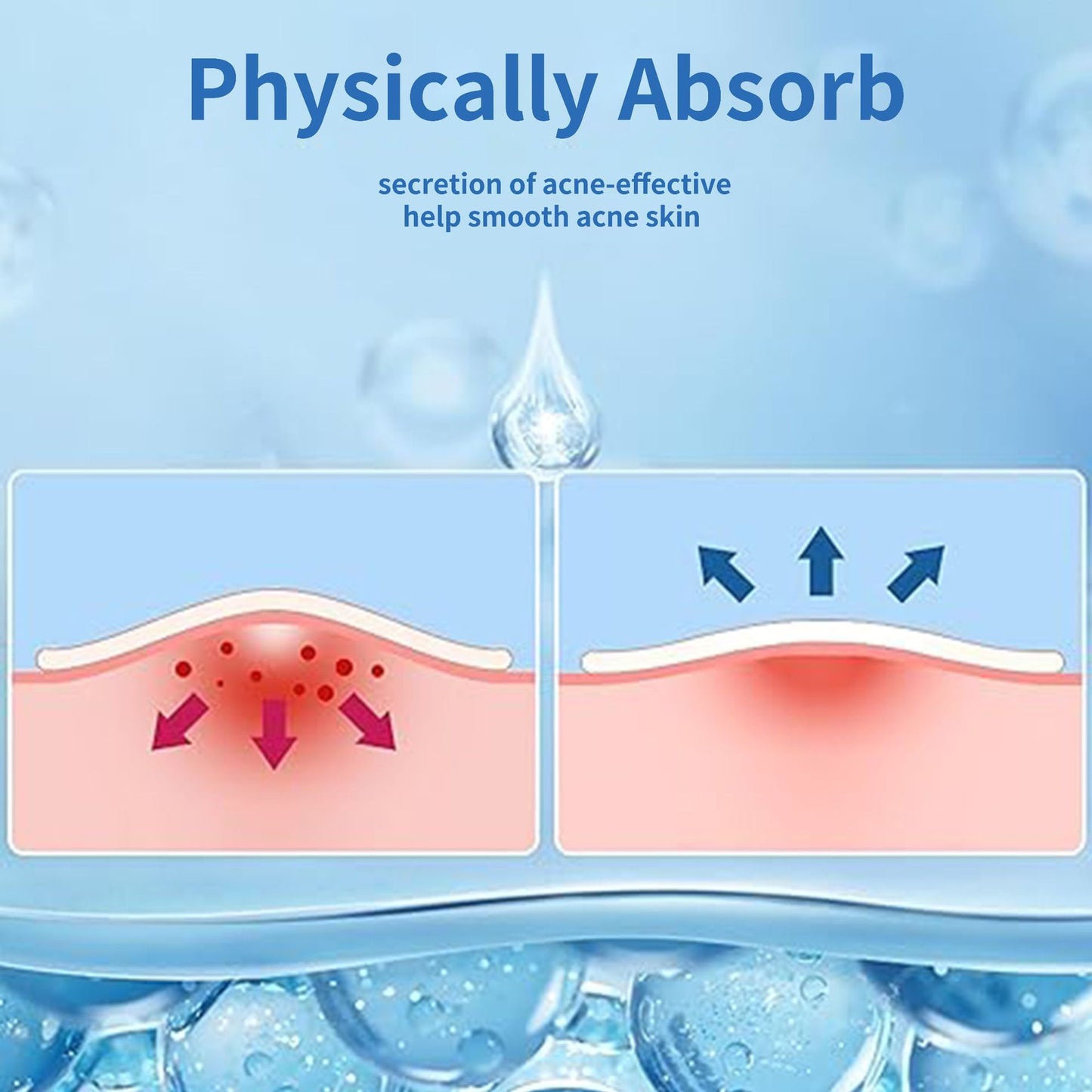 Pimple Patch for Covering Zits and Blemishes 200 Patchs Round-shaped / Star-shaped