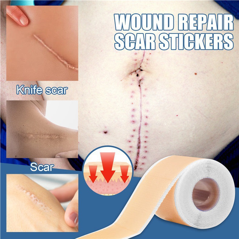 Medical Grade Silicone Scar Tape 1.6”x 60” Roll-1.5M 2 Units